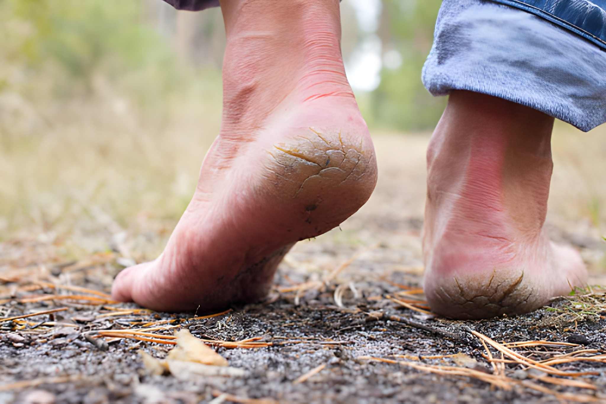 In Bedford-Stuyvesant, Brooklyn, you will find specialized podiatry care for cracked feet
